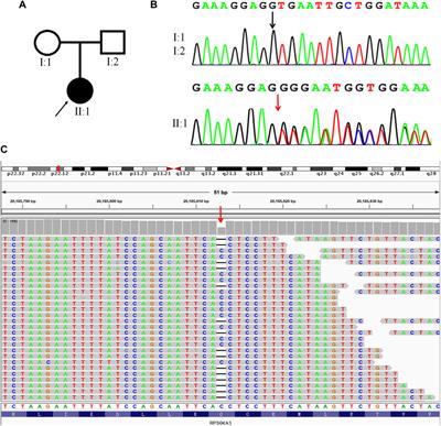 Establishment of linkage phase, using Oxford Nanopore Technologies, for preimplantation genetic testing of Coffin-Lowry syndrome with a de novo RPS6KA3 mutation